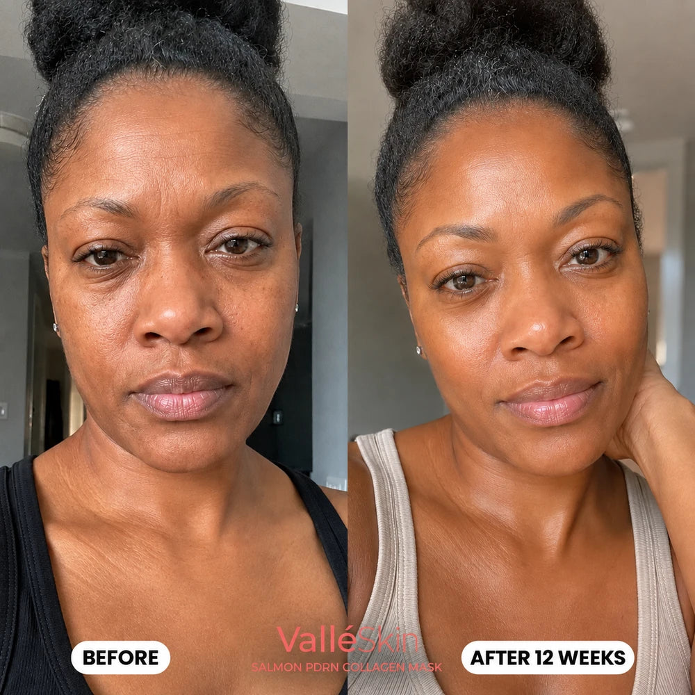 Salmon DNA Collagen Mask