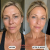 Salmon DNA Collagen Mask