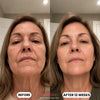 Salmon DNA Collagen Mask