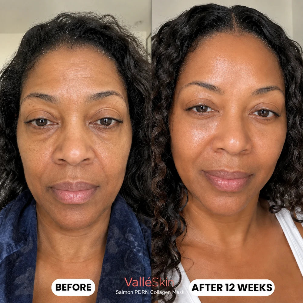 Salmon DNA Collagen Mask