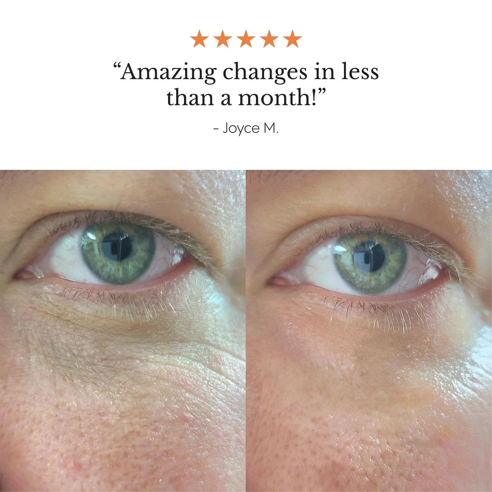 Dark Circle Eye Balm