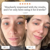 Dark Circle Eye Balm