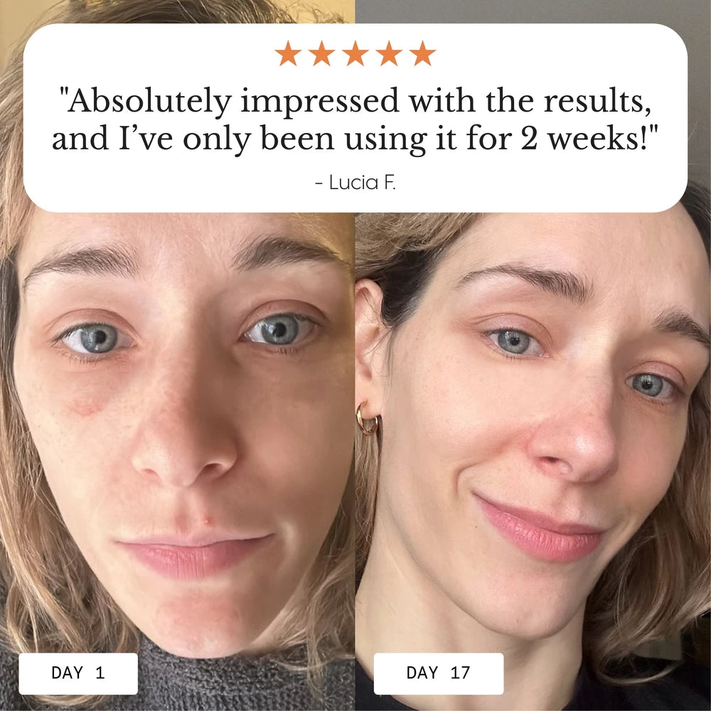 Dark Circle Eye Balm