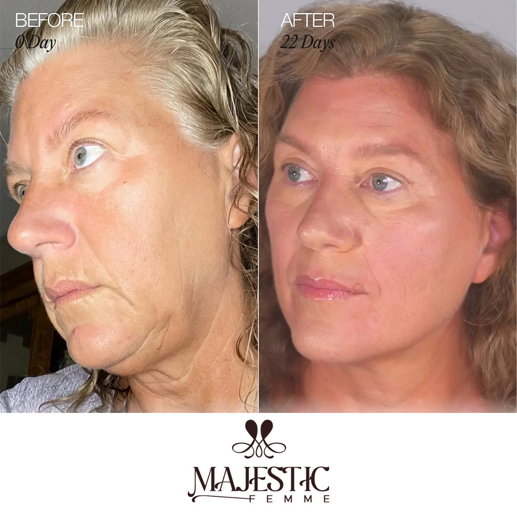 ContourLift Brush – Sculpt & Lymphatic Contour Face