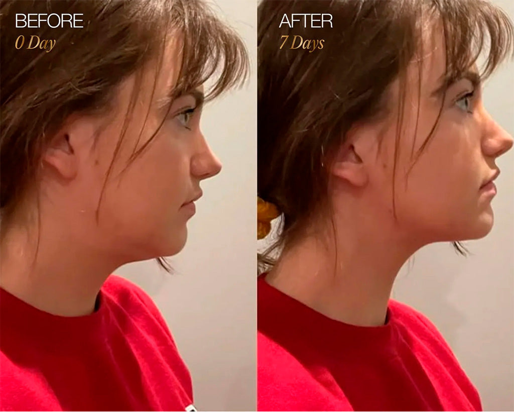 ContourLift Brush – Sculpt & Lymphatic Contour Face