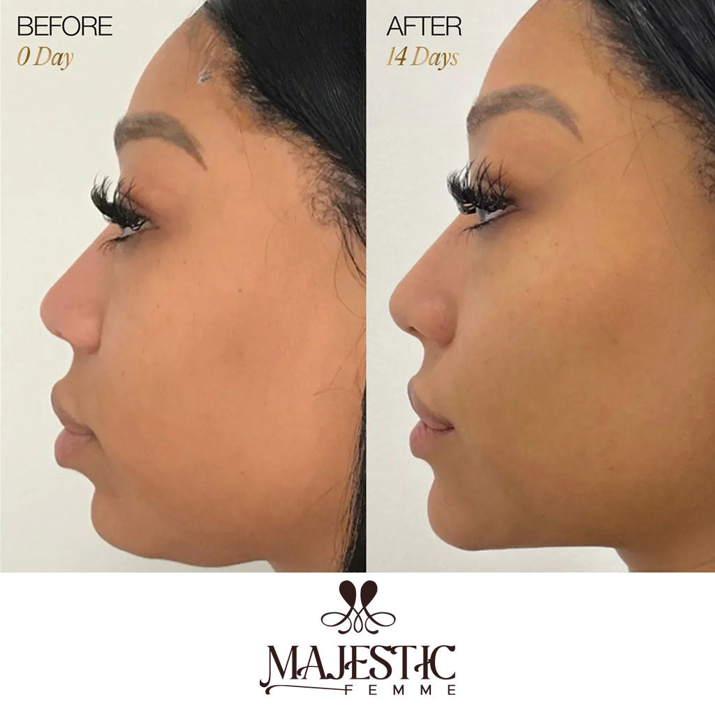 ContourLift Brush – Sculpt & Lymphatic Contour Face