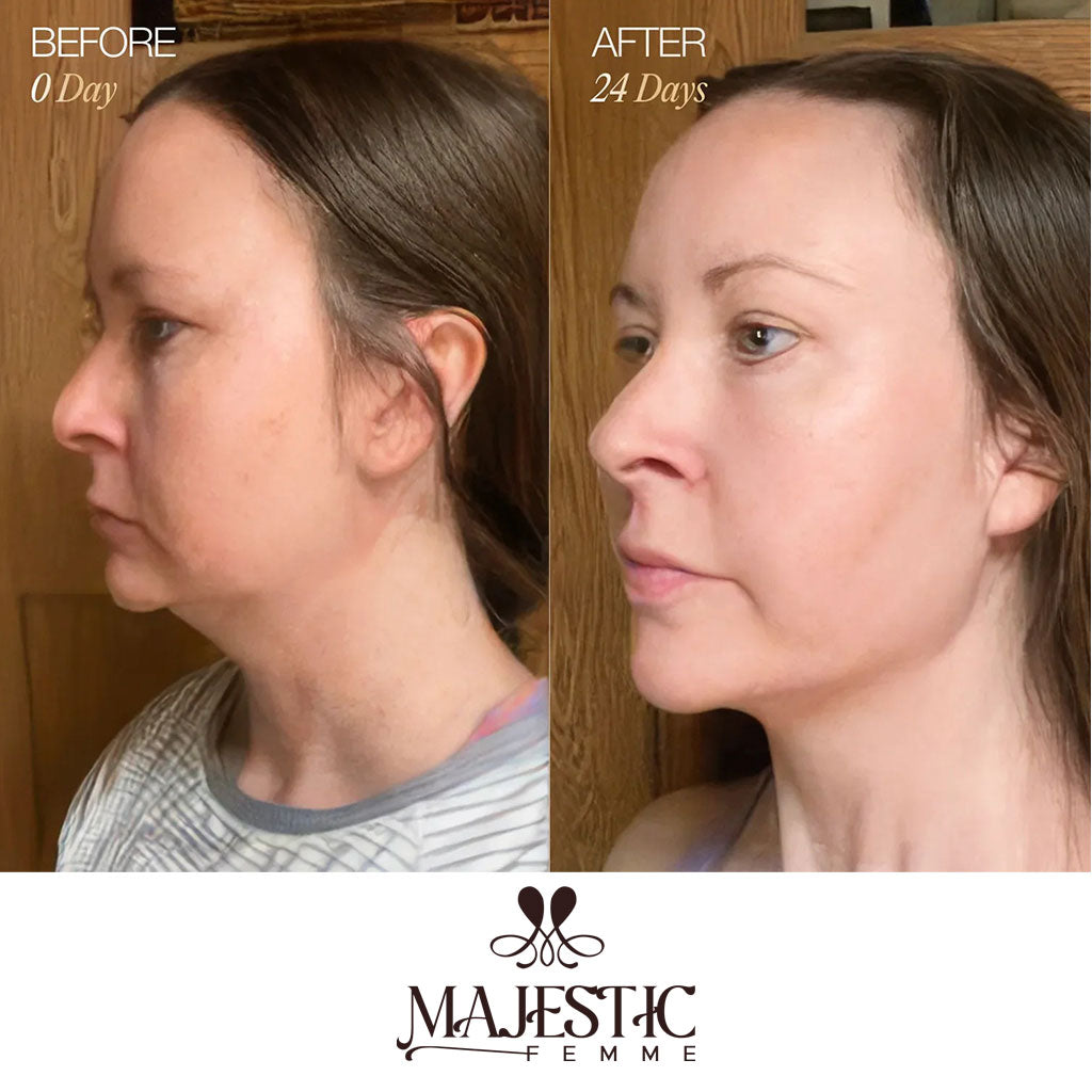 ContourLift Brush – Sculpt & Lymphatic Contour Face