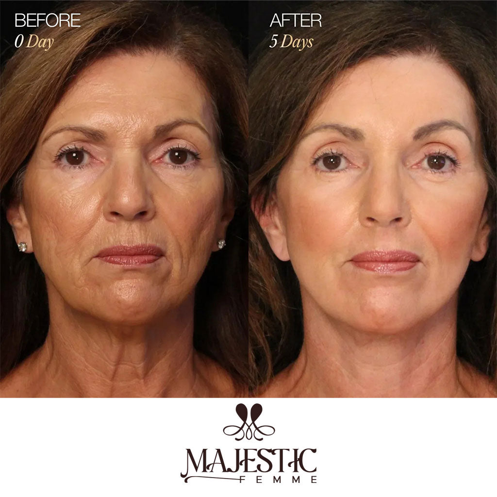 ContourLift Brush – Sculpt & Lymphatic Contour Face