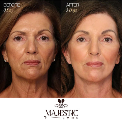 ContourLift Brush – Sculpt & Lymphatic Contour Face